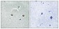 NDUFB10 Polyclonal Antibody